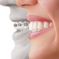 Finding Dental Office in Springfield, VA – Things to look out for