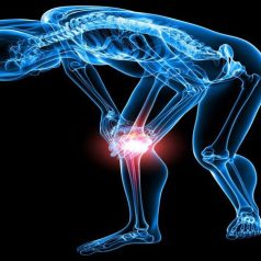 Common Reasons to See an Orthopedic Surgeon in Panama City, FL