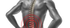 How Physical Therapy can Alleviate Back Pain