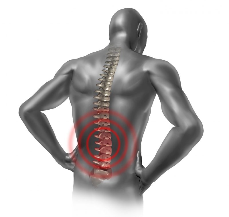 Jacksonville Doctors May Make These Recommendations to Reduce Back Pain