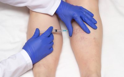 Experience Cutting-Edge Regeneration with PRP Injections in Brentwood, CA