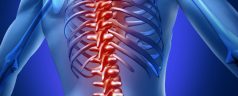 Pain in the Spine Is a Big Deal and Here’s What You Should Know About It