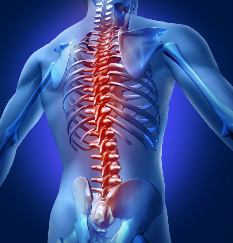 Pain in the Spine Is a Big Deal and Here’s What You Should Know About It