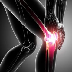 How Do You Live with Arthritis Pain in Jacksonville?