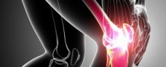 How Do You Live with Arthritis Pain in Jacksonville?