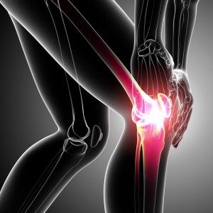 How Do You Live with Arthritis Pain in Jacksonville?