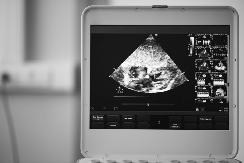 Use a Top SC Company Offering a Portable Ultrasound Machine for Sale