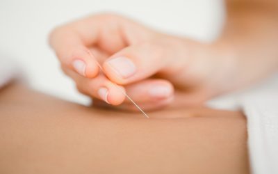 Relieve Chronic Discomfort Using Acupuncture For Pain Bellingham, WA Solutions