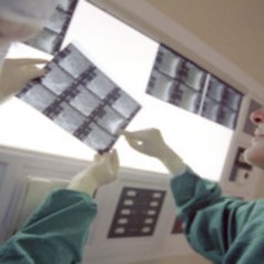 Anesthesia Awareness Facts for National Anesthesia Services