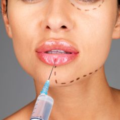 Information on Juvederm in Ellis, TX