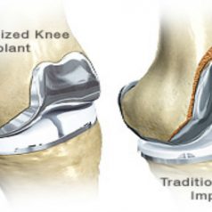 Heal Your Pain with the Best Orthopedic Doctors in Panama City, FL